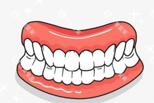 牙齿模型卡通图 牙齿模型卡通图