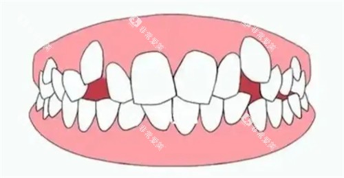 不美观牙齿 不美观牙齿