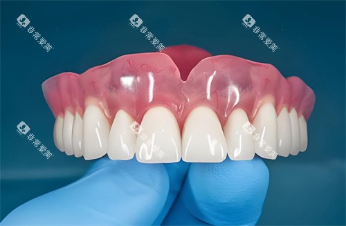 全口种植牙齿图片