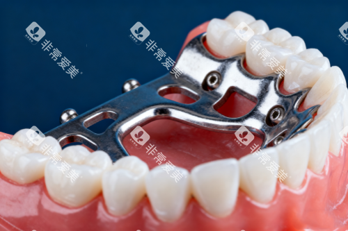 全口假牙模型展示 全口假牙模型展示