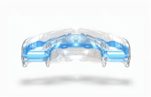 Myobrace牙齿排齐 Myobrace牙齿排齐