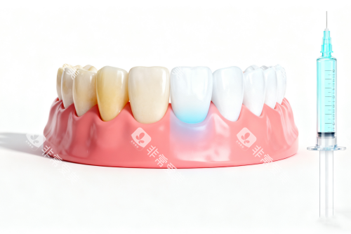 牙齿美白前后对比图一览 牙齿美白前后对比图一览