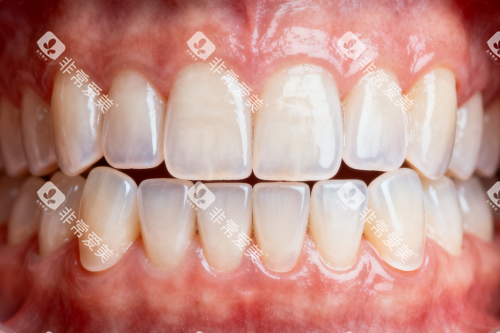 干净整洁牙齿卡通图