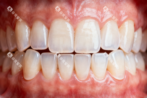 干净整洁牙齿卡通图