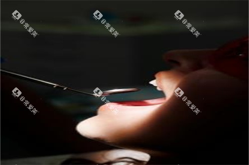 牙齿检查宣传展示