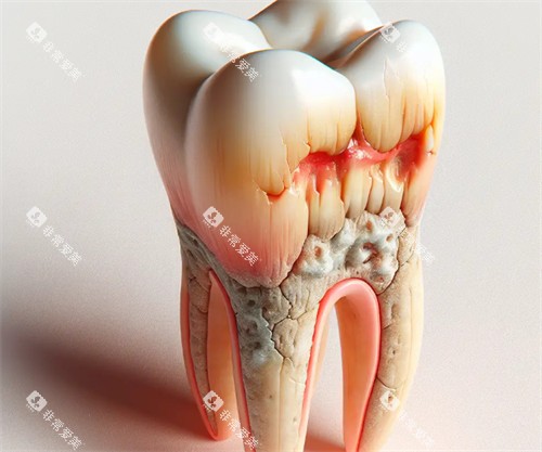 牙齿为什么会掉