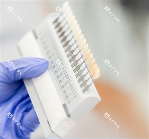 牙齿贴面不同颜色