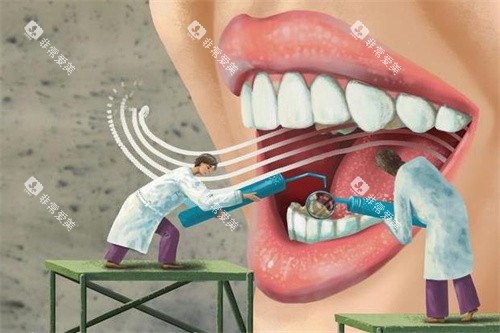 牙齿检查做治疗图 牙齿检查做治疗图
