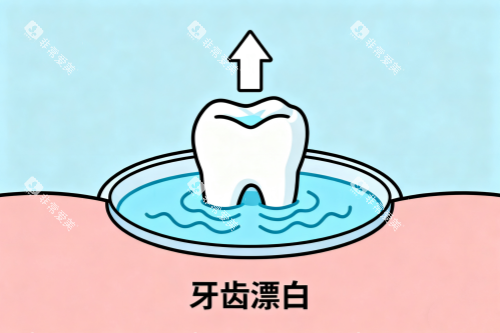 牙齿漂白卡通图 牙齿漂白卡通图