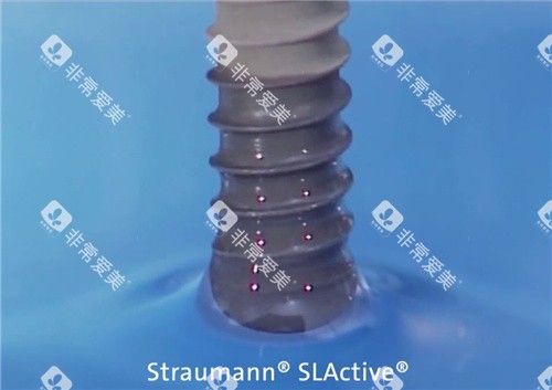 瑞士士卓曼iti亲水型种植牙