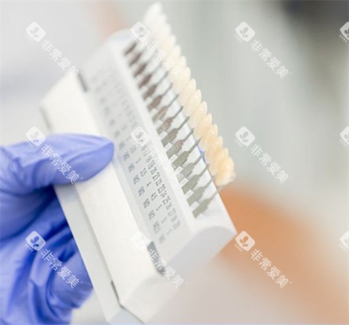 牙齿贴面不同颜色