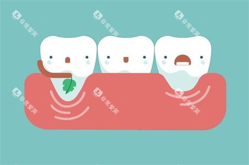 牙齿治疗过程卡通图 牙齿治疗过程卡通图