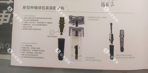 百康特种植牙设计结构图片