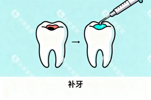 补牙修复展示图