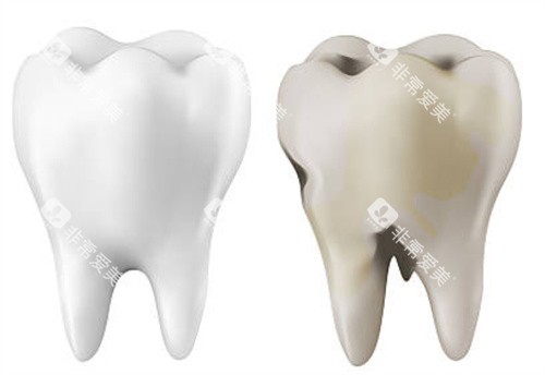 正常牙齿和坏的牙齿