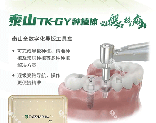 泰山种植牙怎么样 泰山种植牙怎么样