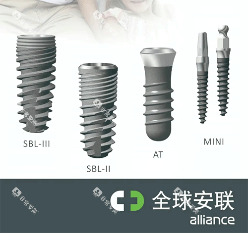 安联种植牙好不好 安联种植牙好不好