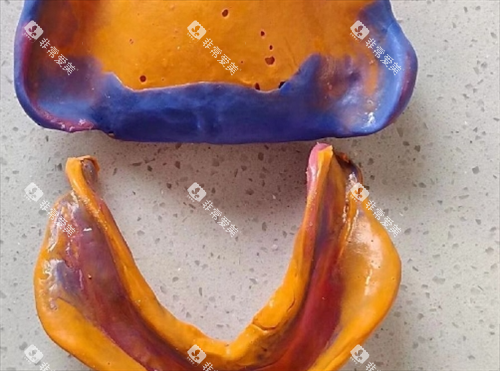 活动义齿磨具展示