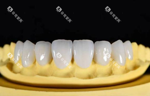 全瓷牙模拟展示