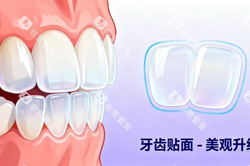 牙齿贴面美白牙齿卡通图 牙齿贴面美白牙齿卡通图