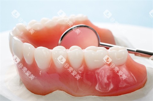 全口全瓷牙的样子