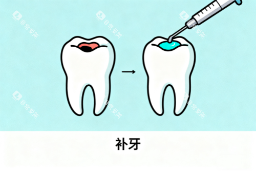 补牙修复展示图 补牙修复展示图