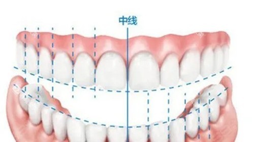牙齿中线.webp 牙齿中线.webp