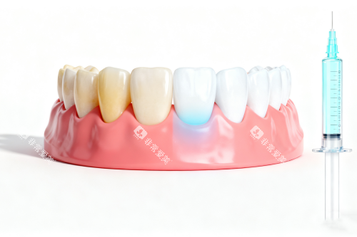 牙齿美白前后对比图一览 牙齿美白前后对比图一览