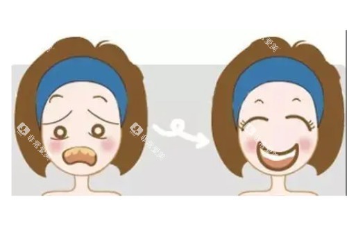 牙齿美白卡通图片一览 牙齿美白卡通图片一览