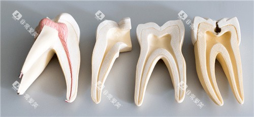 牙齿横截面 牙齿横截面