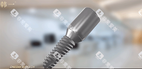 韩一种植牙好不好 韩一种植牙好不好