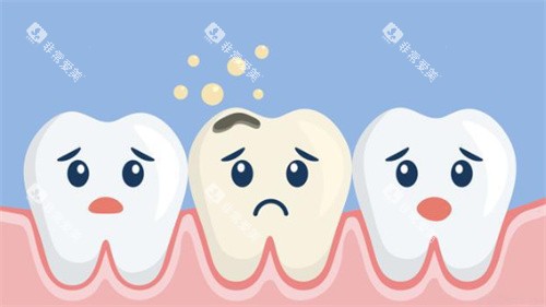 牙齿敏感 牙齿敏感