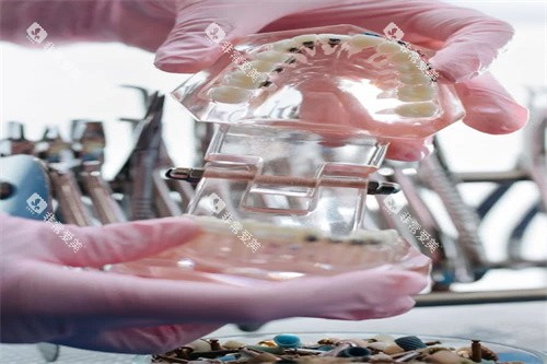 牙齿模型示意 牙齿模型示意