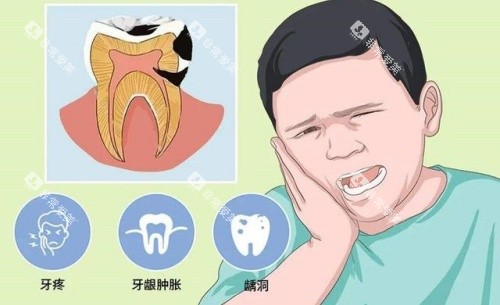 牙齿疾病示意图 牙齿疾病示意图