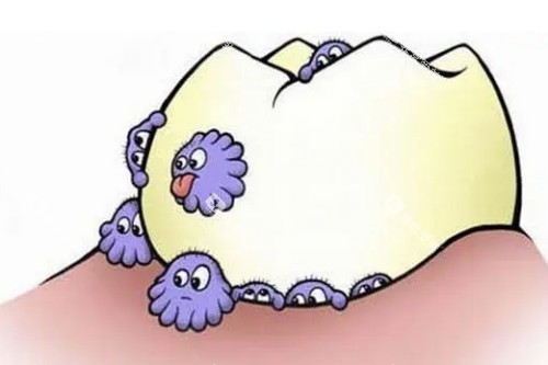 牙齿有细菌卡通展示图 牙齿有细菌卡通展示图