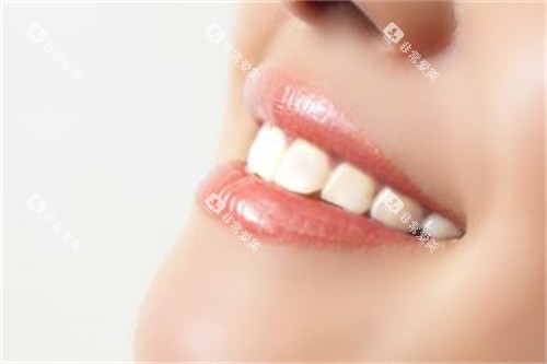 洁白整齐的牙齿宣传图 洁白整齐的牙齿宣传图