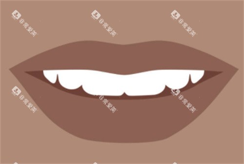 牙齿洁白图 牙齿洁白图