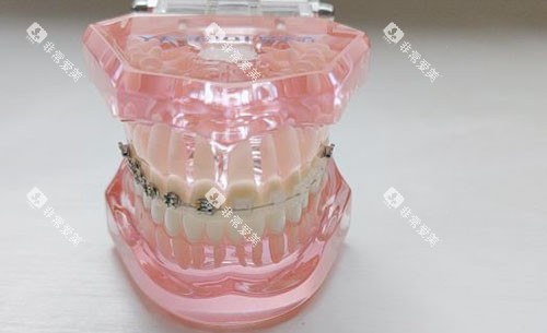 杭州雀辉口腔牙齿模型展示 杭州雀辉口腔牙齿模型展示