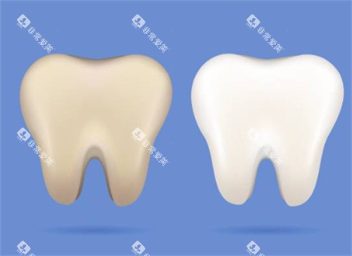 牙齿美白前后图 牙齿美白前后图