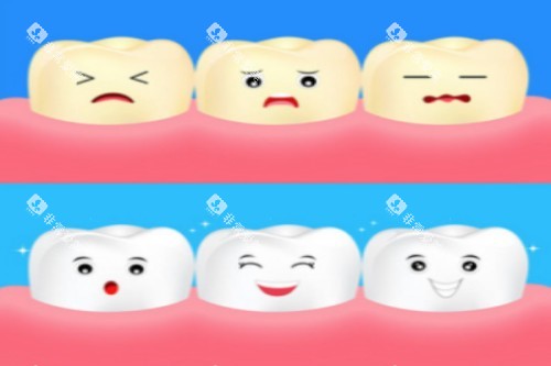 牙齿美白卡通展示 牙齿美白卡通展示