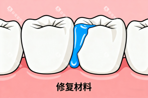 牙齿修复材料展示图 牙齿修复材料展示图