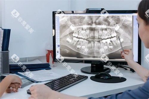 牙齿检查后沟通 牙齿检查后沟通