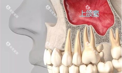 牙齿内部展示图 牙齿内部展示图