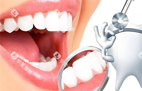 检查牙齿图片 检查牙齿图片