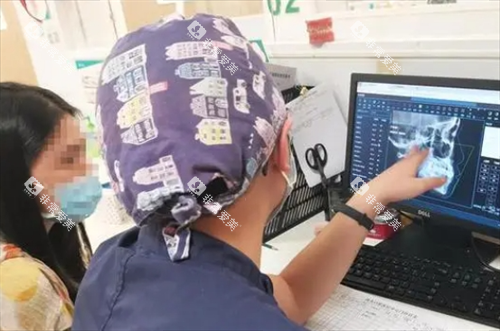 隐形矫正过程医生讲解牙齿情况