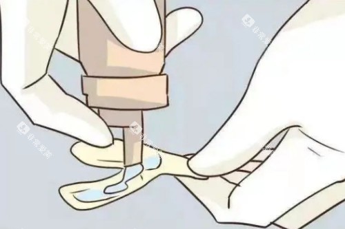 儿牙涂氟展示图