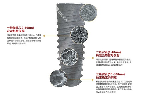 卡尔斯种植牙表面技术 卡尔斯种植牙表面技术