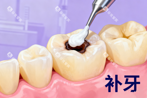 补牙卡通展示图