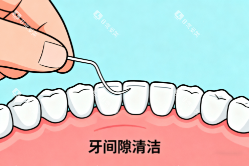 牙齿间隙清洁卡通图