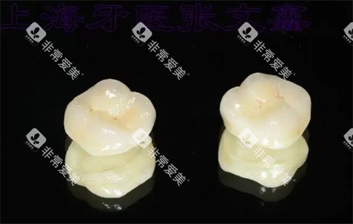 爱尔创全瓷牙外观